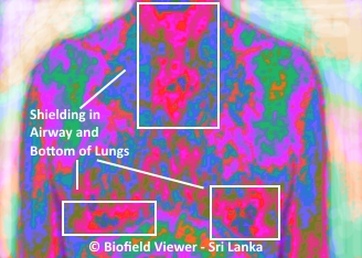 Biofield Scan Image - Chest - Smoker